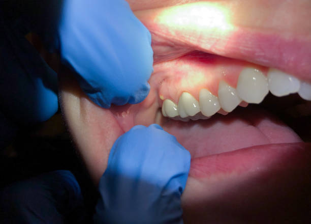 Trusted AR Emergency Dentist Experts